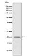 ADP Ribosylation Factor 1 antibody, M01279-1, Boster Biological Technology, Western Blot image 