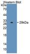 Leucine Rich Repeat Containing 3C antibody, abx130480, Abbexa, Western Blot image 