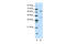 Forkhead Box P4 antibody, 29-132, ProSci, Western Blot image 