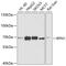 Ribophorin I antibody, 22-440, ProSci, Western Blot image 