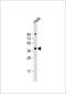 DnaJ homolog subfamily B member 4 antibody, 61-193, ProSci, Western Blot image 