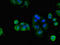 Frizzled Class Receptor 1 antibody, LS-C678000, Lifespan Biosciences, Immunofluorescence image 