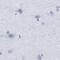Radial Spoke Head Component 1 antibody, PA5-53497, Invitrogen Antibodies, Immunohistochemistry frozen image 