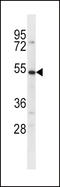 Solute Carrier Family 39 Member 14 antibody, LS-C161239, Lifespan Biosciences, Western Blot image 