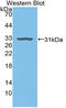 Plasminogen antibody, LS-C314727, Lifespan Biosciences, Western Blot image 