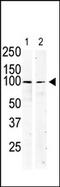c-Kit antibody, AP14374PU-N, Origene, Western Blot image 