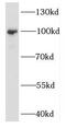 Exosome Component 10 antibody, FNab02900, FineTest, Western Blot image 