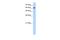 ADAM Metallopeptidase Domain 30 antibody, A11894, Boster Biological Technology, Western Blot image 