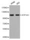 ATPase Na+/K+ Transporting Subunit Alpha 1 antibody, TA326844, Origene, Western Blot image 