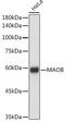 Monoamine Oxidase B antibody, GTX55711, GeneTex, Western Blot image 