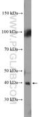 Hypoxia Inducible Factor 1 Subunit Alpha Inhibitor antibody, 10646-1-AP, Proteintech Group, Western Blot image 
