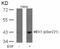 Mitogen-Activated Protein Kinase Kinase 1 antibody, 79-179, ProSci, Western Blot image 