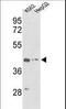 Actin Gamma 1 antibody, LS-B11095, Lifespan Biosciences, Western Blot image 