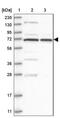 Crystallin Beta-Gamma Domain Containing 2 antibody, NBP1-90618, Novus Biologicals, Western Blot image 