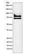 DEAD-Box Helicase 17 antibody, M01656, Boster Biological Technology, Western Blot image 