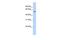 Solute Carrier Family 49 Member 4 antibody, GTX45920, GeneTex, Western Blot image 