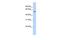 Solute Carrier Family 49 Member 4 antibody, GTX45920, GeneTex, Western Blot image 