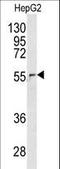 Nucleoporin 62 antibody, LS-C163078, Lifespan Biosciences, Western Blot image 