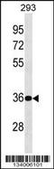 Biphenyl Hydrolase Like antibody, 59-728, ProSci, Western Blot image 