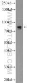 Leucine Rich Repeats And WD Repeat Domain Containing 1 antibody, 19546-1-AP, Proteintech Group, Western Blot image 