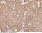 Ubiquitination Factor E4A antibody, 101019-T08, Sino Biological, Immunohistochemistry frozen image 