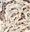 Thyroid Stimulating Hormone Subunit Beta antibody, GTX81137, GeneTex, Immunohistochemistry paraffin image 