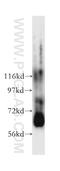 ATP Binding Cassette Subfamily E Member 1 antibody, 51008-2-AP, Proteintech Group, Western Blot image 