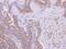 Kelch Repeat And BTB Domain Containing 3 antibody, GTX123289, GeneTex, Immunohistochemistry paraffin image 
