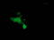 Mahogunin Ring Finger 1 antibody, LS-C172847, Lifespan Biosciences, Immunofluorescence image 