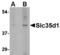 UDP-glucuronic acid/UDP-N-acetylgalactosamine transporter antibody, A11935, Boster Biological Technology, Western Blot image 