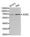 Estrogen Receptor 2 antibody, A2546, ABclonal Technology, Western Blot image 