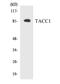 Transforming Acidic Coiled-Coil Containing Protein 1 antibody, EKC1648, Boster Biological Technology, Western Blot image 