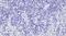 GLI Family Zinc Finger 2 antibody, LS-C54915, Lifespan Biosciences, Immunohistochemistry paraffin image 