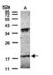 Interferon Alpha 6 antibody, orb69718, Biorbyt, Western Blot image 