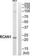 Regulator Of Calcineurin 1 antibody, TA312514, Origene, Western Blot image 