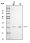 Cyclin Dependent Kinase Inhibitor 2D antibody, A04390-2, Boster Biological Technology, Western Blot image 