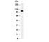 Fibroblast Growth Factor Receptor 2 antibody, R30343, NSJ Bioreagents, Western Blot image 