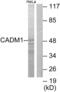 SYNCAM antibody, abx013924, Abbexa, Western Blot image 