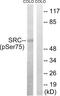 SRC Proto-Oncogene, Non-Receptor Tyrosine Kinase antibody, LS-C199602, Lifespan Biosciences, Western Blot image 