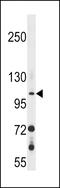 Retinal guanylyl cyclase 2 antibody, LS-C166744, Lifespan Biosciences, Western Blot image 