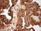 Granulin Precursor antibody, LS-C791204, Lifespan Biosciences, Immunohistochemistry paraffin image 