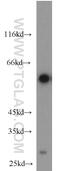 Solute Carrier Family 45 Member 2 antibody, 10453-1-AP, Proteintech Group, Western Blot image 