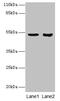 S-Phase Kinase Associated Protein 2 antibody, CSB-PA613392LA01HU, Cusabio, Western Blot image 