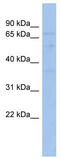 TATA-Box Binding Protein Associated Factor 6 Like antibody, TA331161, Origene, Western Blot image 