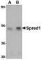 Sprouty Related EVH1 Domain Containing 1 antibody, orb75074, Biorbyt, Western Blot image 