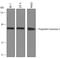 Proprotein Convertase Subtilisin/Kexin Type 2 antibody, AF6018, R&D Systems, Western Blot image 