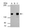 SWI/SNF Related, Matrix Associated, Actin Dependent Regulator Of Chromatin Subfamily C Member 1 antibody, NBP2-20415, Novus Biologicals, Immunoprecipitation image 