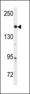 ABL Proto-Oncogene 1, Non-Receptor Tyrosine Kinase antibody, 61-626, ProSci, Western Blot image 