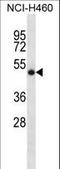 Suppressor Of Cytokine Signaling 4 antibody, LS-C161382, Lifespan Biosciences, Western Blot image 