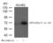 Activating Transcription Factor 2 antibody, PA5-37533, Invitrogen Antibodies, Western Blot image 